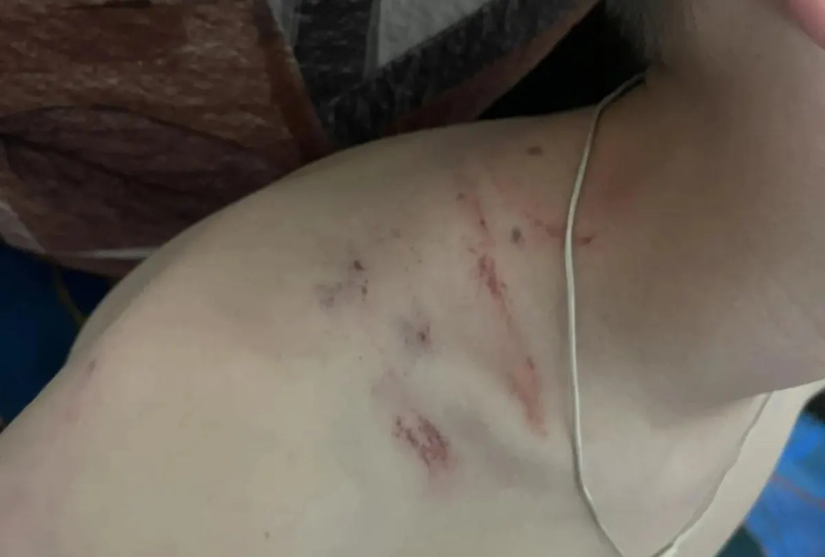 В закрытом поселке ЗАТО Горный в Забайкальском крае военнослужащий ударил 11‑летнего мальчика после того, как тот взял велосипед; у ребёнка зафиксированы ушибы, полиция подтвердила факт происшествия и проводит проверку.