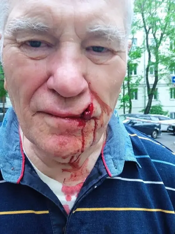 Во&nbsp;Владивостоке сосед избил 85‑летнего пенсионера из‑за&nbsp;вскопанной клумбы